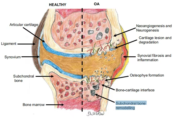 央视重磅：细胞疗法入选“中国科学十大进展”！干细胞单次注射实现骨关节炎1年长效修复