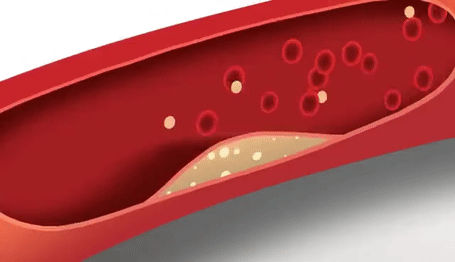 活到九十九｜国家卫健委：减肥不是选择题，是保命题！