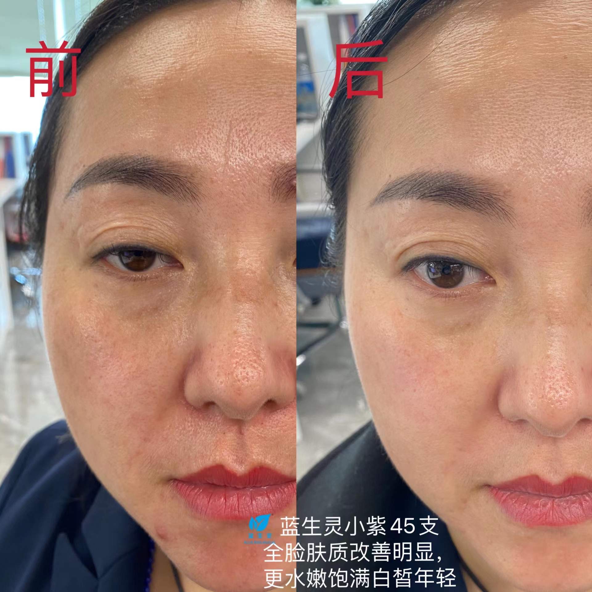 一篇大实话丨读懂年轻五岁，速来围观