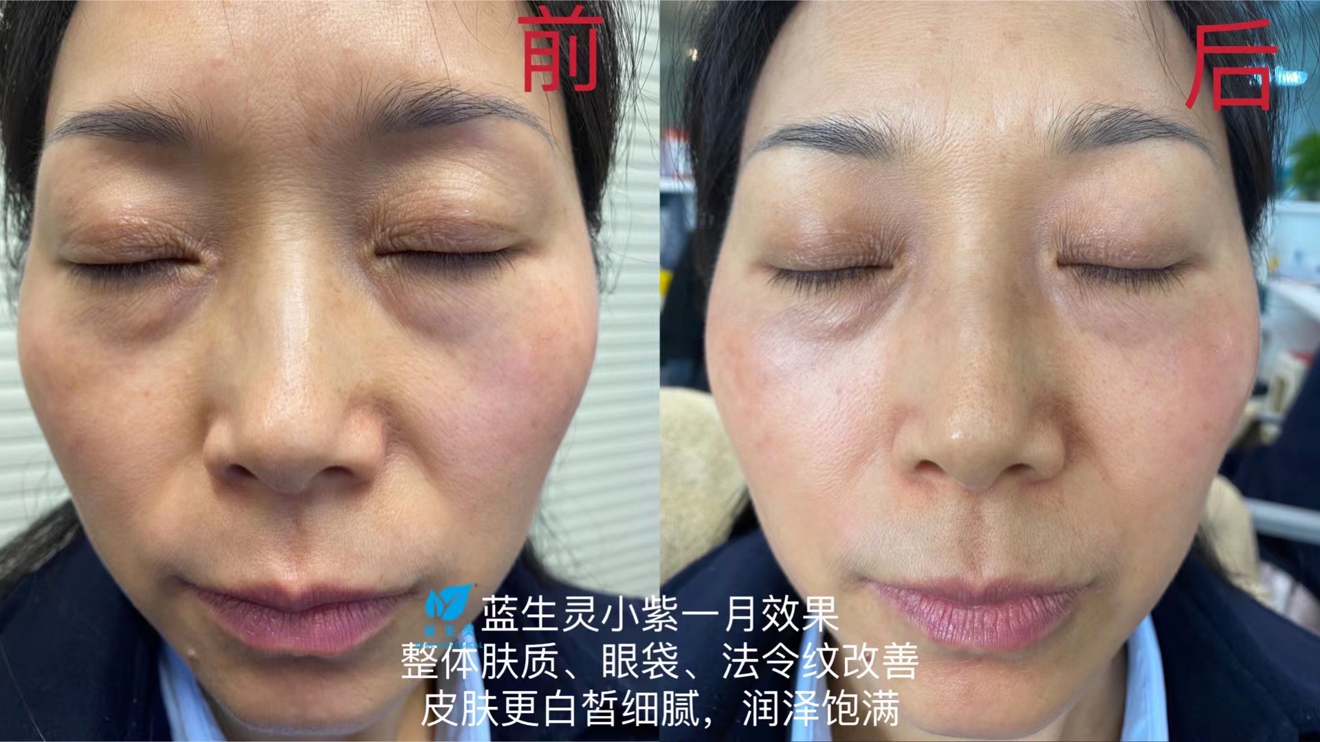 一篇大实话丨读懂年轻五岁，速来围观